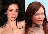 Rose Mcgowan Plastic Surgery Gone Wrong Before and After Pictures ...