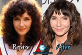 Mary Steenburgen Plastic Surgery, Facelift, Eyelift, Before After Pics ...