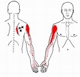 What are Trigger Points? — Plus Forte Physical Therapy