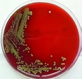 Stenotrophomonas maltophilia - Special Pathogens Laboratory