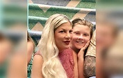 Tori Spelling Plastic Surgery Hell: Injections Leave Her Face A Lumpy Mess
