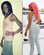 Nicki Minaj Plastic Surgery Before and After Photos - Plastic Surgery Facts