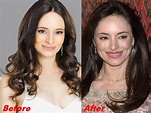 Madeleine Stowe Plastic Surgery Before And After Face Photos