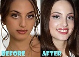 Alexa Ray Joel Plastic Surgery Before and After Nose Job - Lovely ...