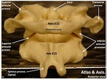 Atlas Vs Axis Vertebra - What is the Difference Between Atlas and Axis ...