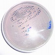 Photograph showing Streptococcus mutans colonies on mitis... | Download ...