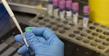 新州首次出現本地傳播猴痘病例 | 澳洲 | 感染病例 | 大紀元
