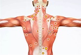 Trigger Point Massage Therapy for Pain Relief | Swedish Institute