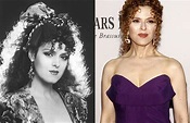 Bernadette Peters Plastic Surgery Before and After Pictures | Celebrity ...