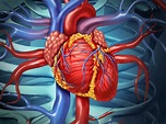 Open-Heart Surgery: Risks, Procedure, and Preparation