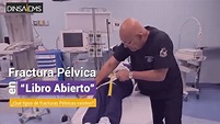 FRACTURA PÉLVICA EN "LIBRO ABIERTO" - YouTube