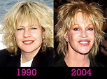 Melanie Griffith Plastic Surgery Before After, Breast Implants