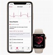 Apple Watch Series 4 ECG Feature Rolls Out Today With watchOS 5.1.2 ...