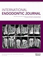 International Endodontic Journal : Vol 50 , No 11