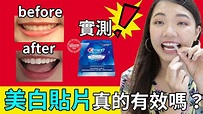 牙齒美白貼片3D CREAST心得分享｜福爾思庭 - YouTube