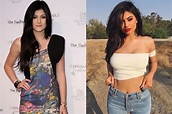 Kylie Jenner plastic surgery: Truth behind transformation revealed | OK ...