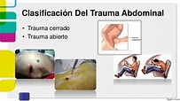 Trauma Abdominal