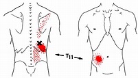 Iliocostalis Thoracis | The Trigger Point & Referred Pain Guide