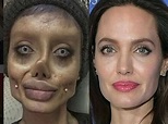 Teen's botched Angelina Jolie plastic surgery roils internet, proves to ...