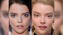 Anya Taylor Joy Plastic Surgery: A Look Into Her Plastic Surgery! - The ...