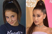 Ariana Grande Before & After: The Power of Plastic Surgery! - DemotiX