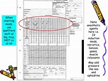PPT - The Anesthesia Chart PowerPoint Presentation, free download - ID ...