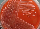 Staphylococcus epidermidis | Medical Laboratories