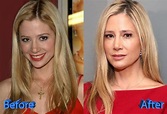 Mira Sorvino Before and After Plastic Surgery | Plastic surgery ...