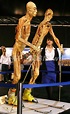 メルボルンで実物の人体標本展 写真7枚 国際ニュース：AFPBB News
