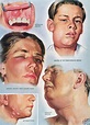 Doctoring The Craft Of Medical Illustration – The Work Of Frank H ...