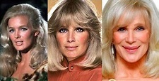 Linda Evans Plastic Surgery Before and After - Celebrity Plastic ...
