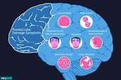 Una descripción general del daño del lóbulo frontal - Medicina Básica
