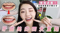 牙齒美白｜維持白皙牙齒的關鍵 這四點非常重要｜福爾思庭 - YouTube