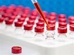 Antibody Titer Test: Purpose, Procedure, and Preparation