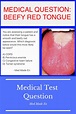 Test Question: Beefy Red Tongue - Med Made Ez (MME) | Medical questions ...