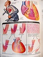 The Ciba Collection of Medical Illustrations, Volume 5, Heart, Frank H ...