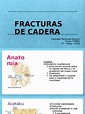 Fracturas de Cadera | Cadera | Sistema musculoesquelético
