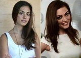 Phoebe Tonkin Plastic Surgery Before and After - Celebrity Surgeries