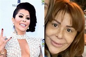 Alejandra Guzmán, así ha sido la transformación de su rostro (FOTOS)