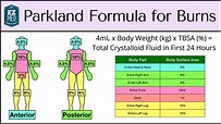 Parkland Formula for Burns: Adult & Pediatric Fluid Resuscitation ...