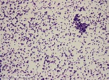 Staphylococcus epidermidis 1,000x 1 | Marc Perkins Photography