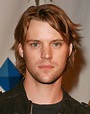 Jesse - Jesse Spencer Photo (1917558) - Fanpop - Page 2