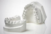 Características ideales de los modelos de yeso para protésicos dentales
