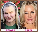 Daryl Hannah Plastic Surgery before and after – Plastic surgery stars