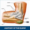 Elbow Bursitis Information | Florida Orthopaedic Institute