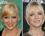 Anna Faris Plastic Surgery: See How the Actress Has Transformed