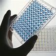 A quick guide to Elisa test