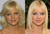 Anna Faris Plastic Surgery: Before and After, Nose Job, Lip Filler