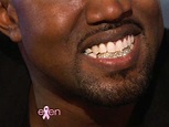 Kanye’s Diamond Teeth? Ask A Dentist - Stereogum