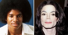 Michael Jackson Plastic Surgery Before After
